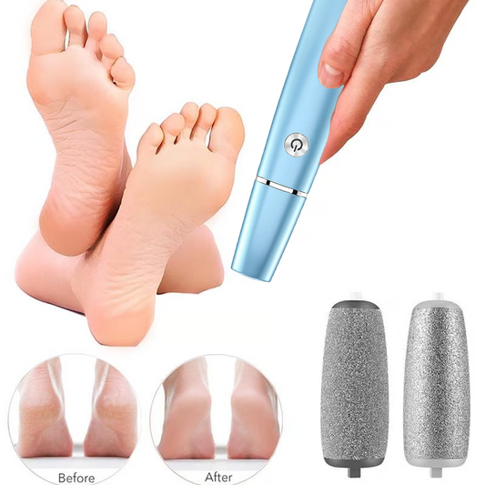 🔥Mother's Day Hot Sale 50%✨Electric Feet Callus Remover⚡