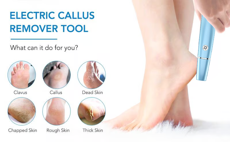 🔥Mother's Day Hot Sale 50%✨Electric Feet Callus Remover⚡