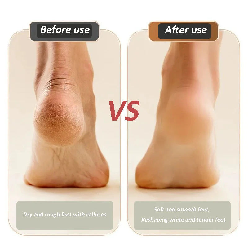 🔥Hot Product🔥USB Rechargeable Foot Repair & Grinding Device – Smooth, Soft Feet Anytime, Anywhere! 🦶✨