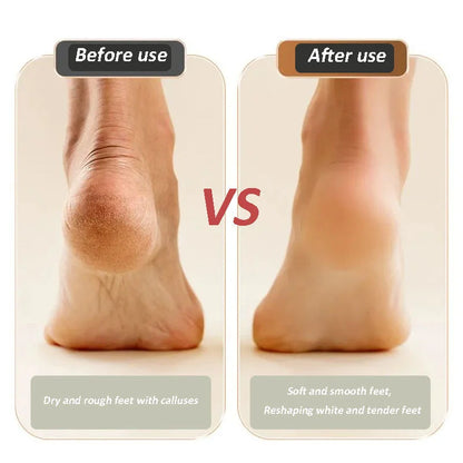 🔥Hot Product🔥USB Rechargeable Foot Repair & Grinding Device – Smooth, Soft Feet Anytime, Anywhere! 🦶✨