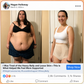💥NEW HOT SALE💥4-in-1 Shaping and Fat-Burning Microfiber Shorts🌸activates warmth & boosts circulation. Supports firmer, smoother contour. No gym needed. A smart shapewear choice. 🧘‍♀️