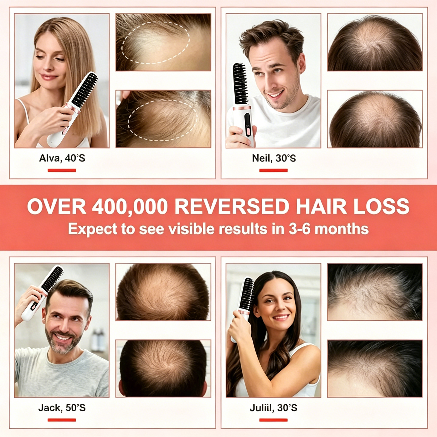 🔥🔥Electric current scalp care and hair strengthening comb