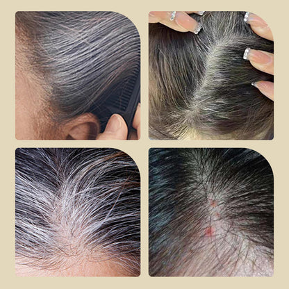 🥰 Limited Time 50% Off🔥 Safe, Easy, and Mess-Free Comb Hair Dye for a Flawless Look!