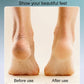 🔥Hot Sale - 50% OFF💕Rechargeable Electric Foot Callus Remover
