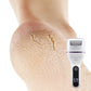 💥Hot Sale 50% Off⏳Portable Electric Foot Callus Remover